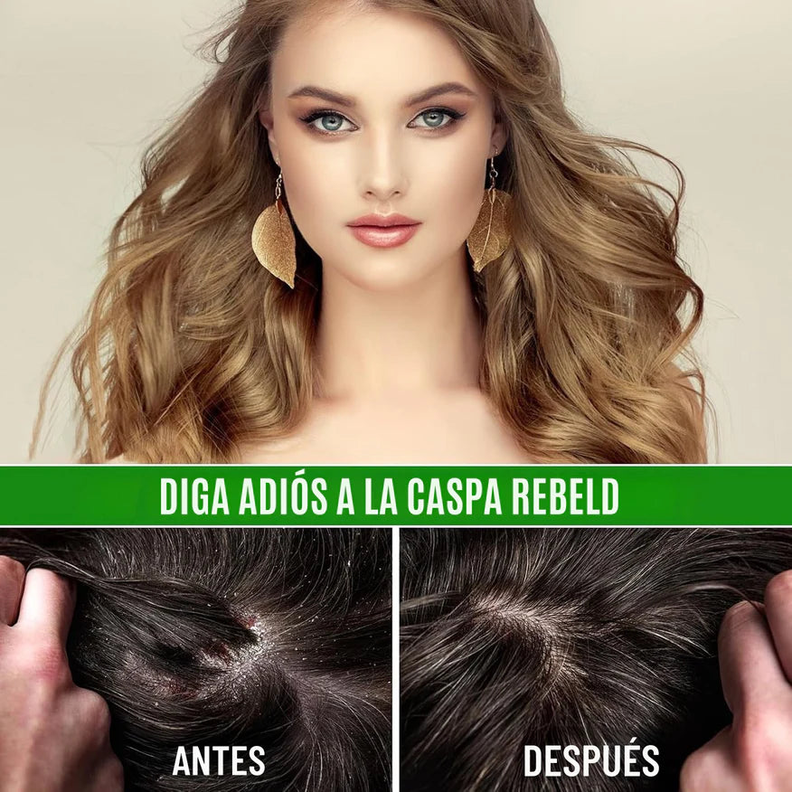 🌿 Aceite de Batana Spray – ¡Crecimiento Capilar Visible, Fuerza y Salud en Cada Aplicación! Compra 1, llévate 2